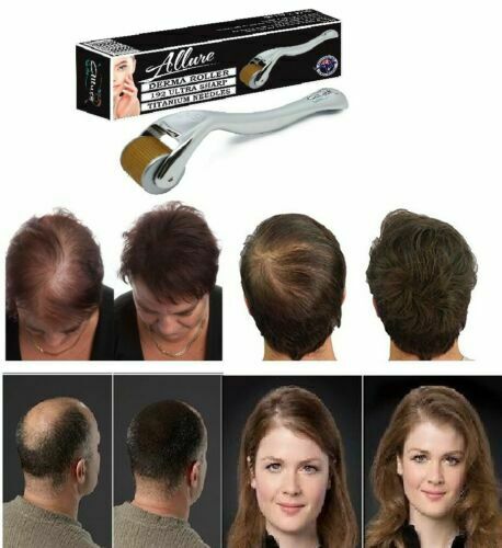 Premium Derma Roller Hair Loss Kit 1.0mm 192 Titanium Micro Needles & Hair Growth Serum ALLURE FOR BEAUTY