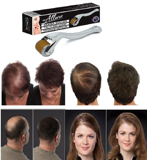 How Derma Rollers can be used for Hair regrowth