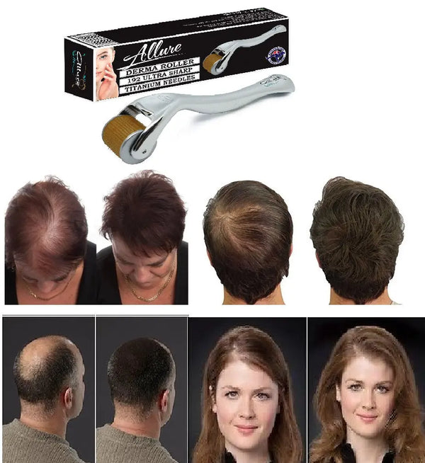 How-Derma-Rollers-can-be-used-for-Hair-regrowth Allure For Beauty