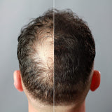 3 Hair Building Fibres 28g 100% Cotton Powder Shaker Bottle Black Brown Thickener Hair Loss Concealer