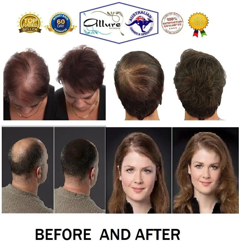 Hair Building Fibers 27g 100% Cotton Powder Shaker Bottle Black Brown Thickener Hair Loss Concealer ALLURE FOR BEAUTY